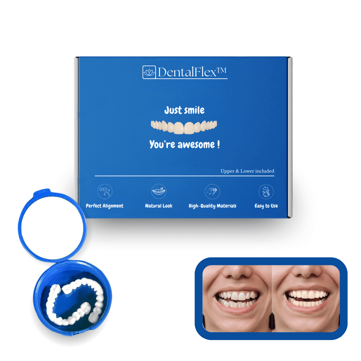 DentalFlex™ | Set de facettes modulables (haut et bas)